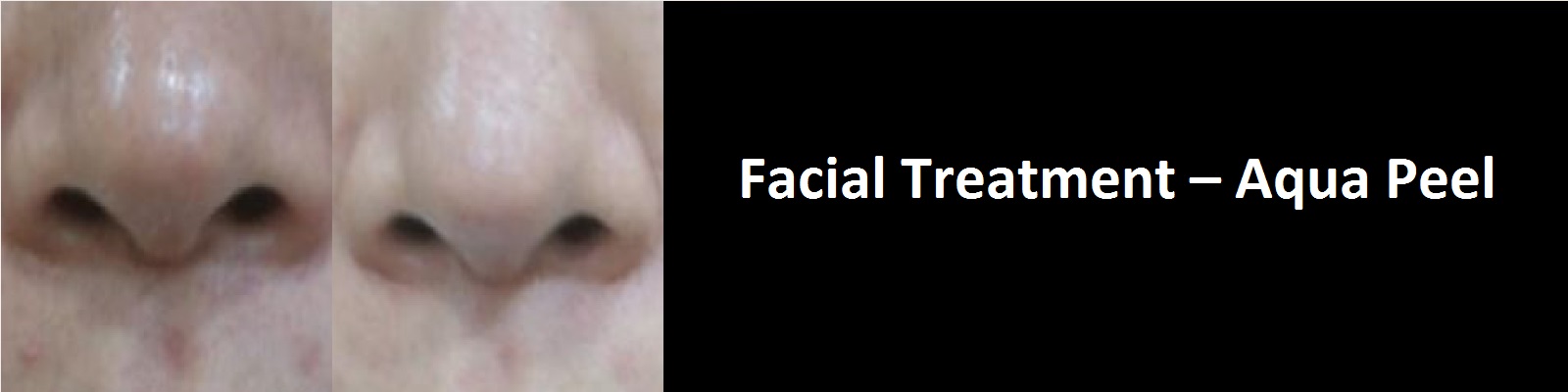 facial-treatment